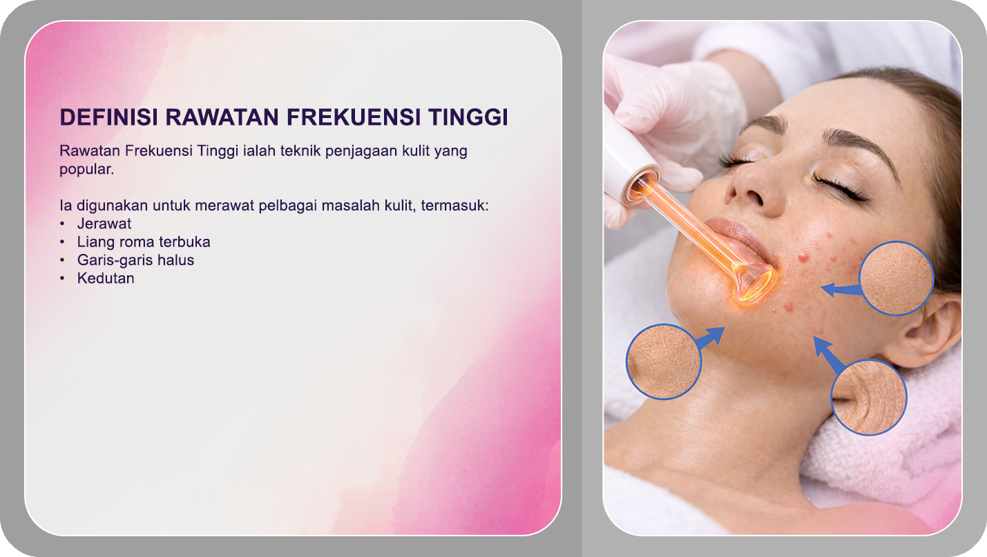 Definisi Rawatan Frekuensi Tinggi